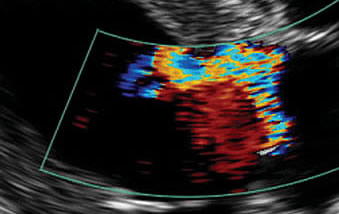 Emma Tobin Ultrasound and Radiology Referrals