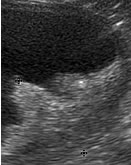 Emma Tobin - Uses of Ultrasound