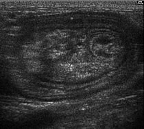 Emma Tobin Ultrasound and Radiology Referrals