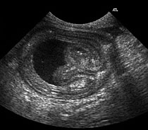 Emma Tobin Ultrasound and Radiology Referrals