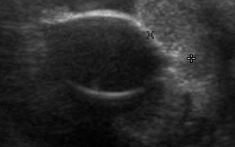 Emma Tobin Ultrasound and Radiology Referrals